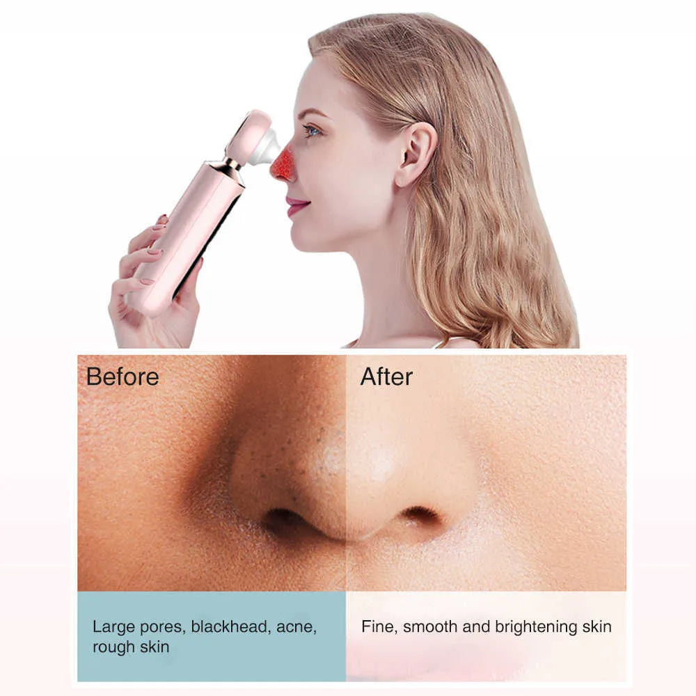 Halah™ Blackhead Suction Machine