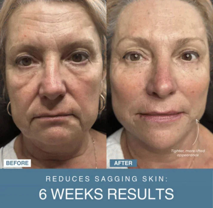 Halah™ 7-in-1 LED Anti-Aging/Wrinkle Apparatus