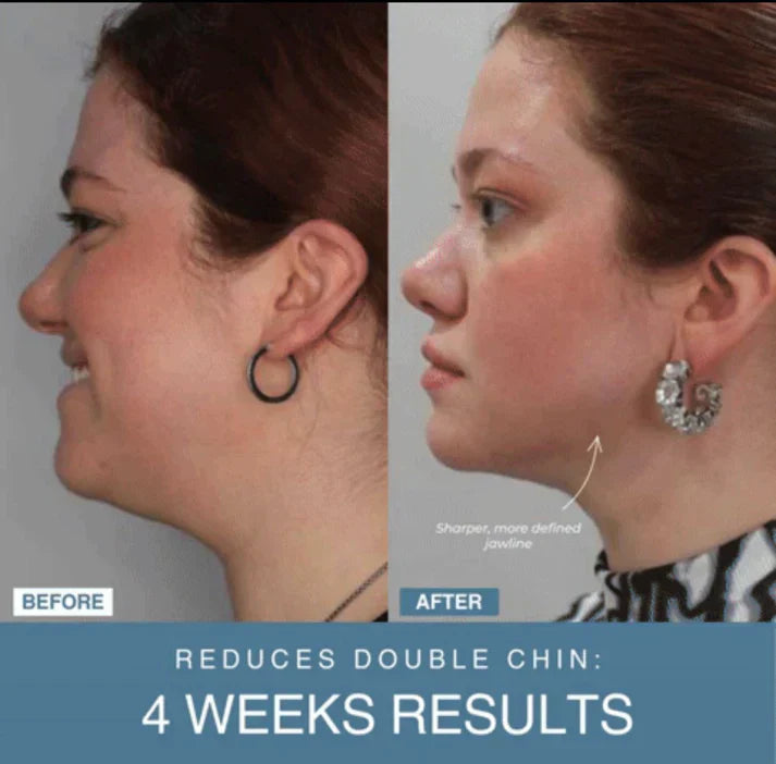Halah™ 7-in-1 LED Anti-Aging/Wrinkle Apparatus